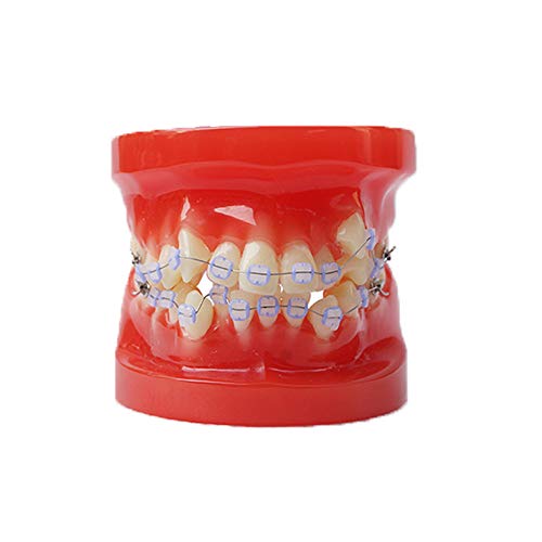 Model de dinți model dentar patologie stomatologie de stomatologie model de predare a cercetării de laborator Utilizarea învățării